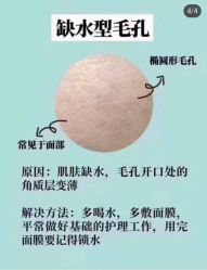 -美肤盾祛痘·问题肌头疗管理中心