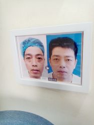 -天津健丽·去眼袋医疗美容机构
