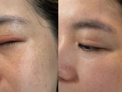 -东森自然美.INDIBA.美容SPA.皮肤管理
