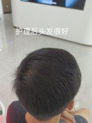 -北京雍禾植发医院