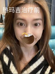 -上海伊莱美医疗美容医院