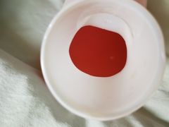 血尿-天津市第三中心医院