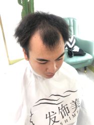 -发饰美男士增发补发假发定制店