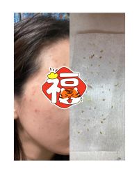 -苗方清颜痘肌研究所