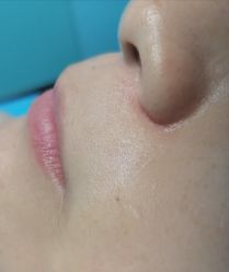 -广州粤秀医疗美容医院