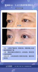 -丰联丽格医疗美容·联合丽格眼整形中心