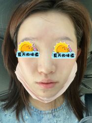 体验后-深圳阳光医疗美容