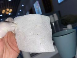 -蕾特恩专业祛痘国际连锁