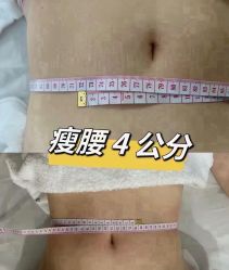 -Lily纤美·科技减脂中心