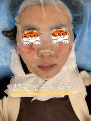 -agge蛋白医美
