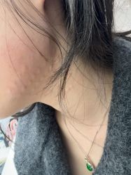 -Yestar宁波艺星整形医院