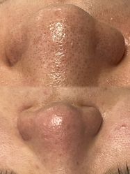 -SKIN79皮肤管理中心