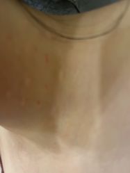 -美瑞莎创美医疗美容