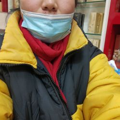 体验前-北京美痣堂古方祛痣斑疣瘊