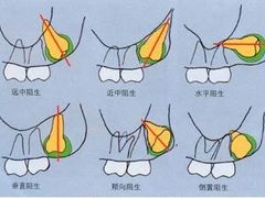 -团圆口腔·种植中心(锦江院区)