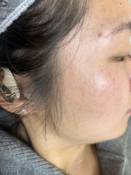 -长沙雅美医疗美容医院