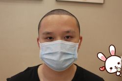 -大麦微针植发丨全国连锁