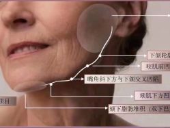 -中科妍美专业脱毛美肤连锁机构