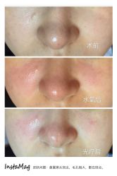 脸部抗衰-光SPA科技美肤