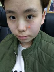 -百年美肤堂祛痦痣祛斑祛疣