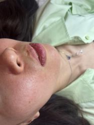 -清疣美疣·痣·斑净肤中心