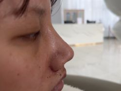 -广州美莱医疗美容医院