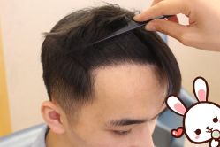 -大麦微针植发丨全国连锁