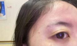 -上海漾颜医疗美容