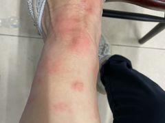 -五七小李子油焖大虾(总店)