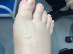 -世龙世家甲沟炎·灰指甲·嵌甲矫正·修脚(武侯区双楠店)