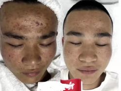 点击看大图 -痘敏医生专业祛痘·肌肤修复连锁
