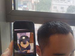 点击看大图 -碧莲盛·不剃发植发