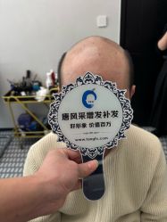 -唐风采假发补发定制