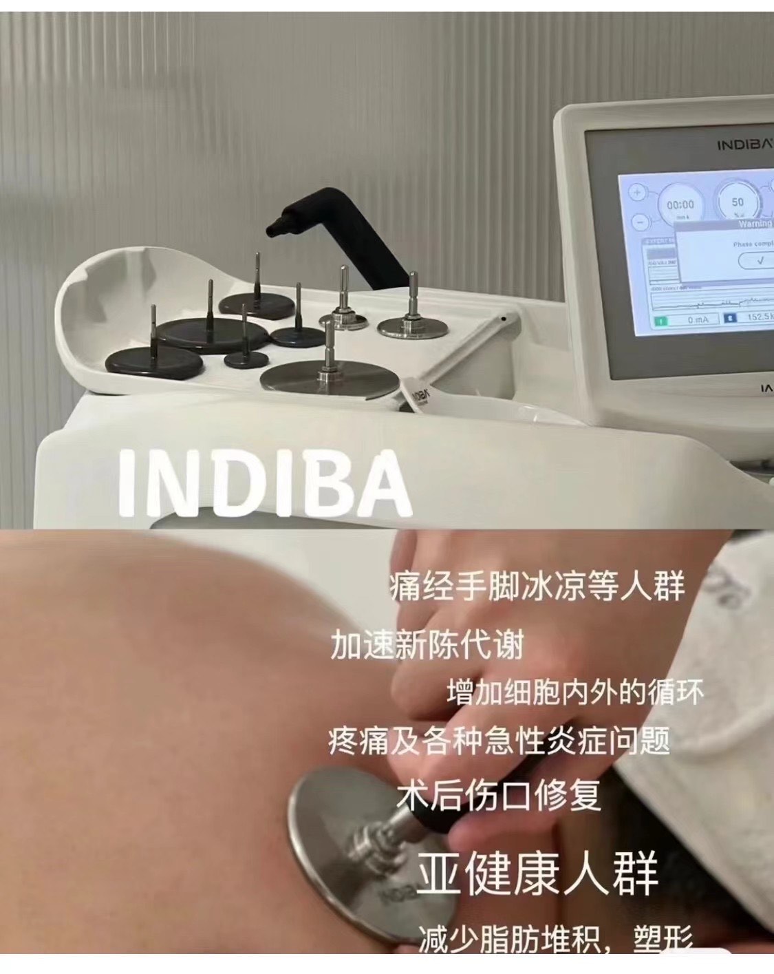 indiba是一台专注于亚健康的仪器