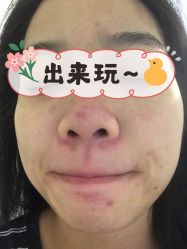 -海峡医疗美容医院