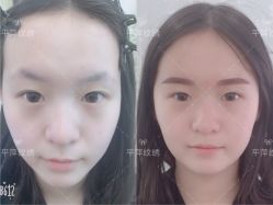 韩式半永久0⃣️结痂粉丝眉-平萍纹绣韩式半永久定妆