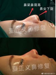 -北京米扬丽格医疗美容·联合丽格鼻整形中心