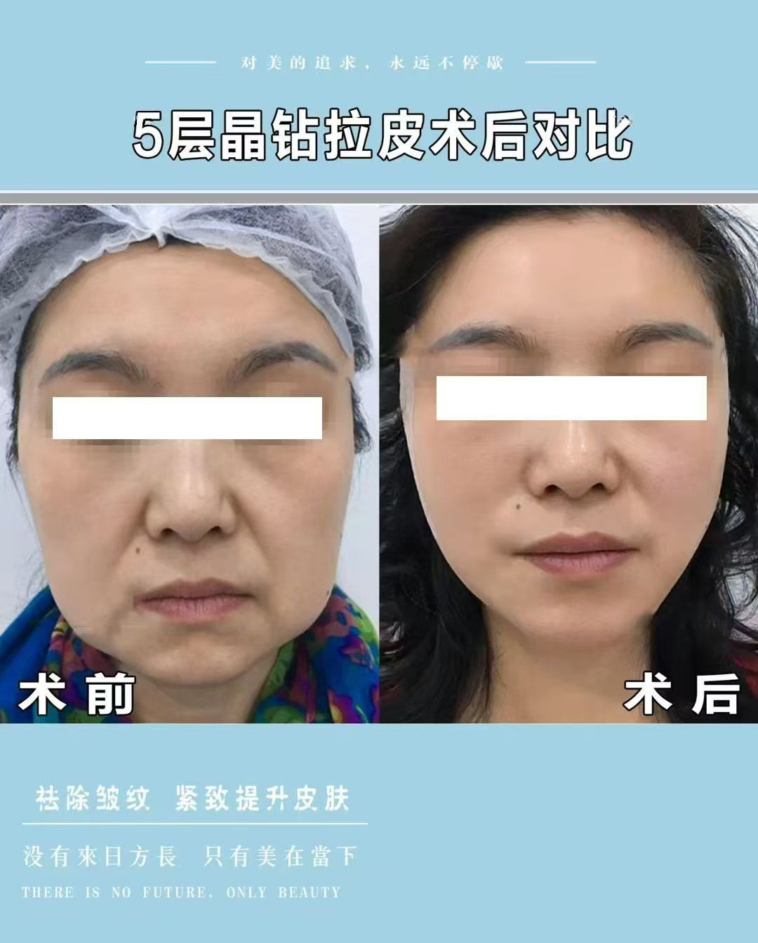 君美施医疗整形拉皮