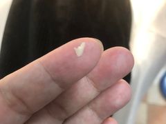 -世龙世家灰指甲鸡眼脚气甲沟炎跖疣护理(通州店)