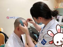 -大麦微针植发丨全国连锁