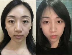 -紫洁俪方（北京）医疗美容