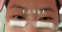 -广州健丽·去眼袋医疗美容机构