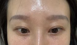 点击看大图 -美莱医疗美容医院