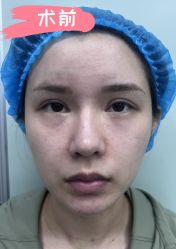 -素美医疗美容·西南眼鼻整形·修复基地