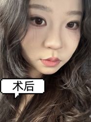 -素美医疗美容·西南眼鼻整形·修复基地