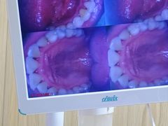 -爱牙联合口腔(门诊报销 海云庵店)