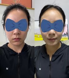 体验前-联合丽格·张菡丽格医疗美容