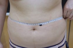 -CMS西美斯·美式医疗美容