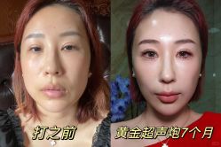 -上海伊莱美医疗美容医院