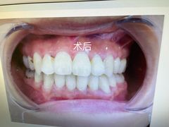 -宁波壹加壹口腔·矫正种植中心